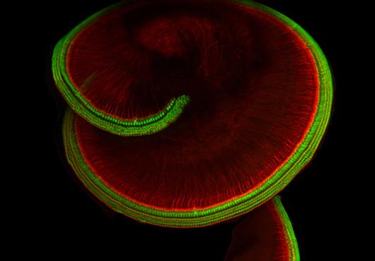 The snail-shell-shaped part of the inner ear that houses hair cells.