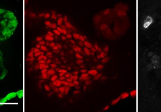 Three squares side by side with a large and a small cell under microscopy: one in green, one in red and one in white