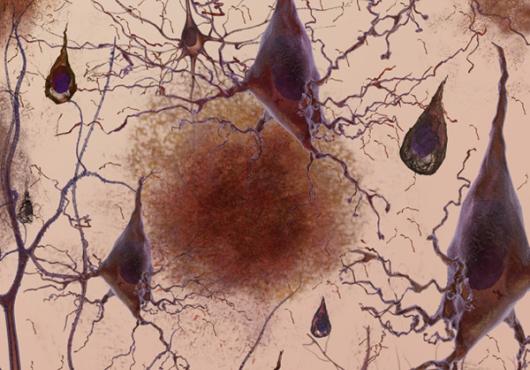 Brain Drain