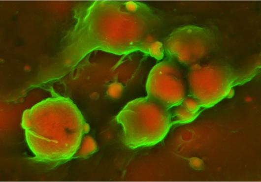 Inside Insights on Cardiovascular Buildup