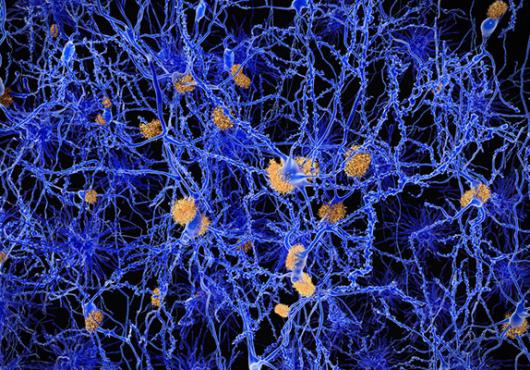 Propelling Alzheimer’s Research
