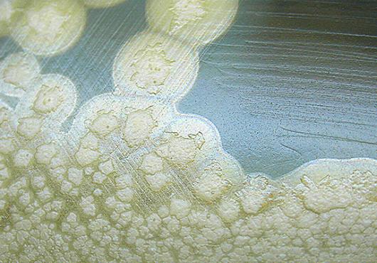 Uncovering Toxin X