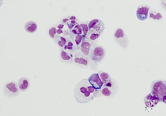 Stem Cells Step Forward