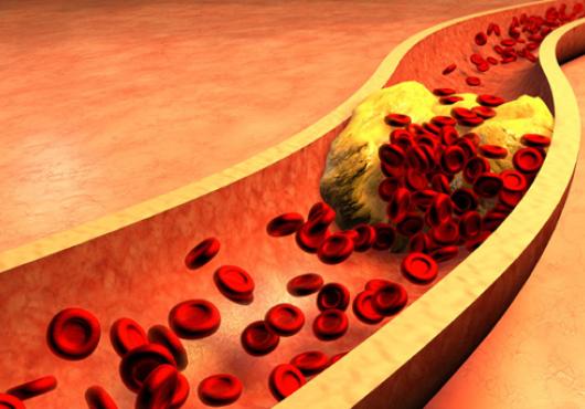 MicroRNAs and Metabolism 