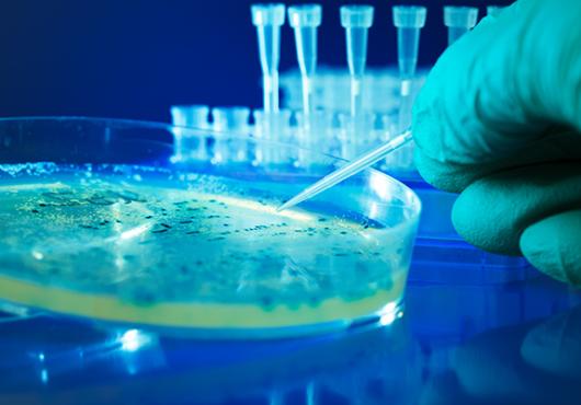 Microbial Murder Mystery Solved