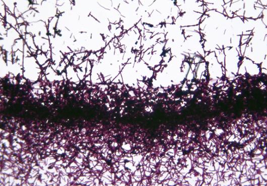 Combating Candida Albicans