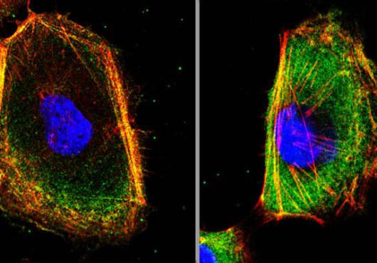 Cytoskeleton Crew