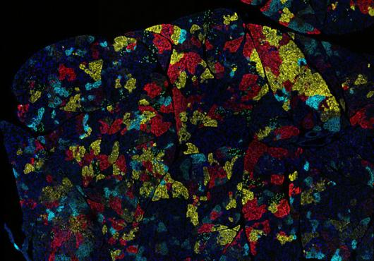 Testing Tumors