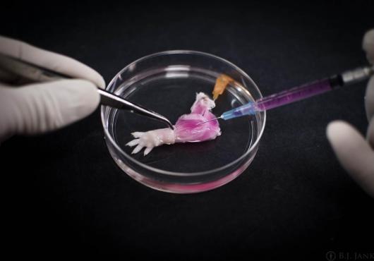 From Matrix to Limb