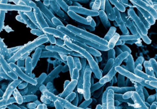 Making a Difference in TB