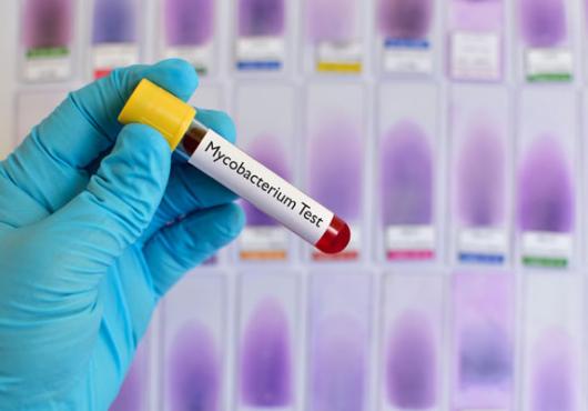 Predicting TB's Behavior
