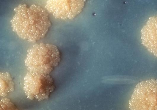 New Blood for TB Treatment