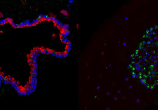 Listening In on Lung Cells