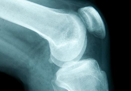 Building Better Bone