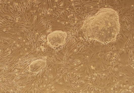 Stem Cell Memory