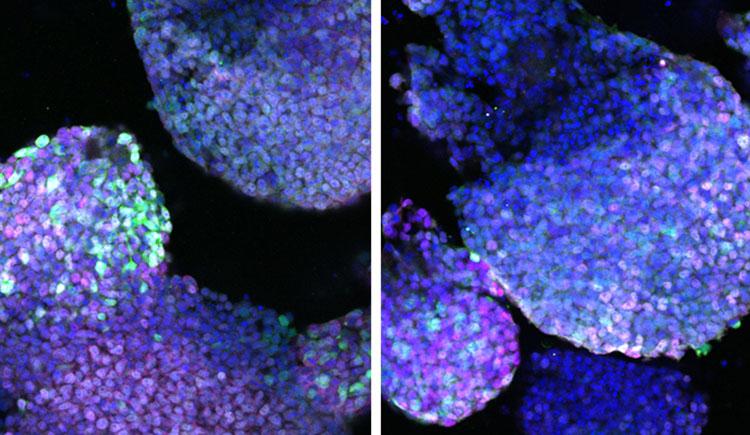 Two side-by-side microscopic images show purple blobs with individual cell nuclei glowing in shades of blue, green, and pink