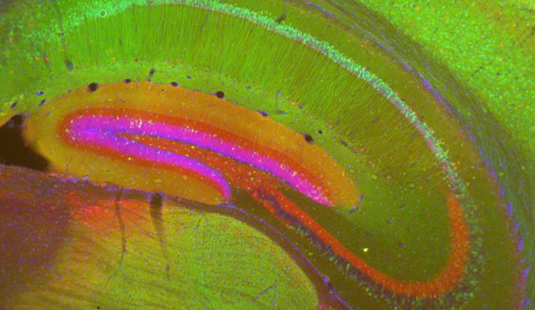 colored cross-section of the hippocampus of a mouse shows several folds one on top of the other