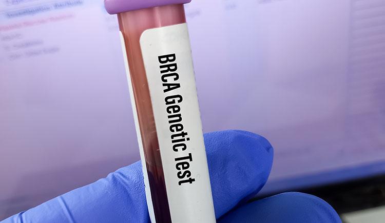 A vial of blood labeled BRCA genetic test