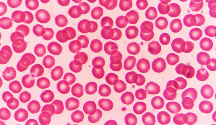 Red blood cells appear as dozens of spheres under a microscope