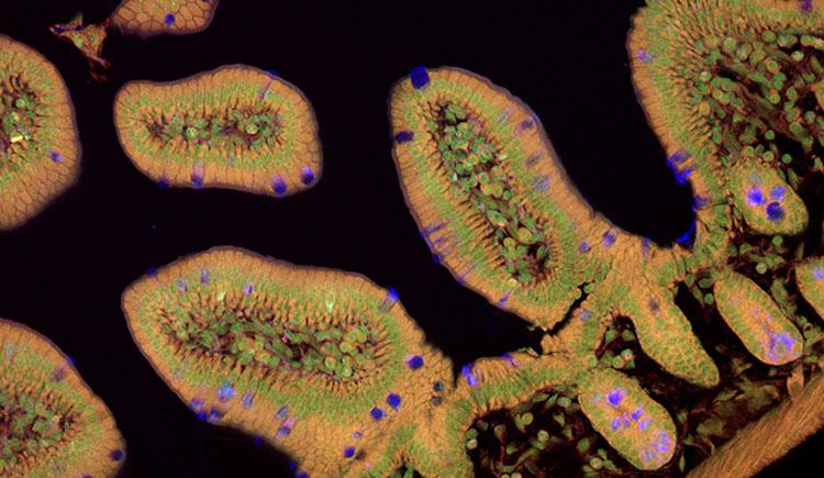 A cross-section of intestinal lining appears like irregular ovals with complex cell structures, shown in brown with green rings and occasional purple cells