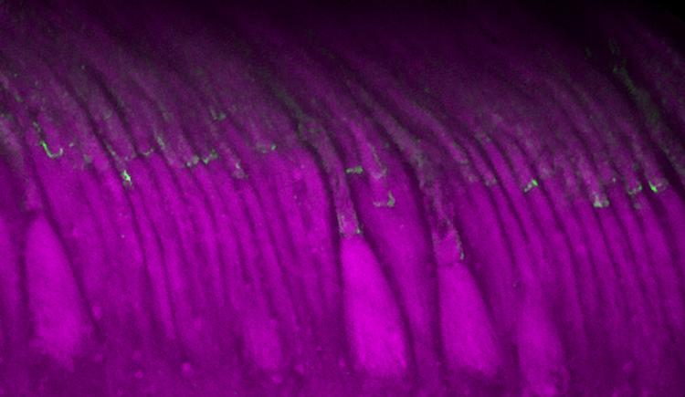 Cells in a row under a microscope have wider bases and long tails bending slightly to the left like reeds in a breeze. Each cell is fluorescently tagged purple with a dot of green about halfway up.