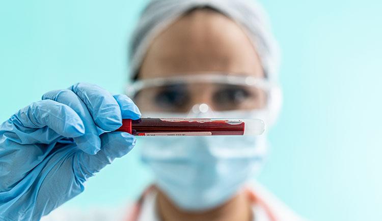 A person wearing protective gloves, glasses, and mask holds a small vial containing a blood sample.