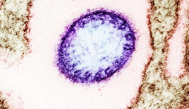 A purple circular Nipah virus particle floats in a field of pink surrounded by brown VERO cells.