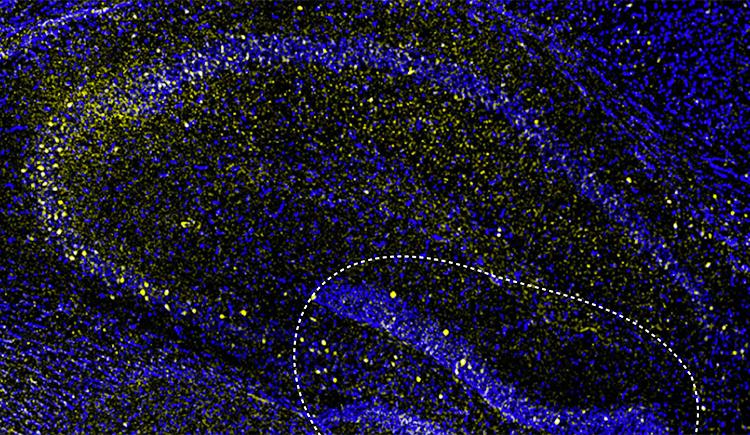 microscope image shows blue swirls with clusters of yellow dots against a black background