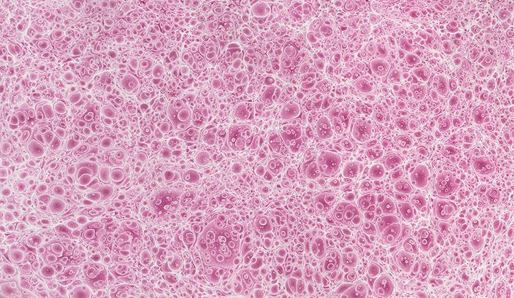A sheet of textured paper with a pattern that appears to be dense, small, pink bubbles or cells.