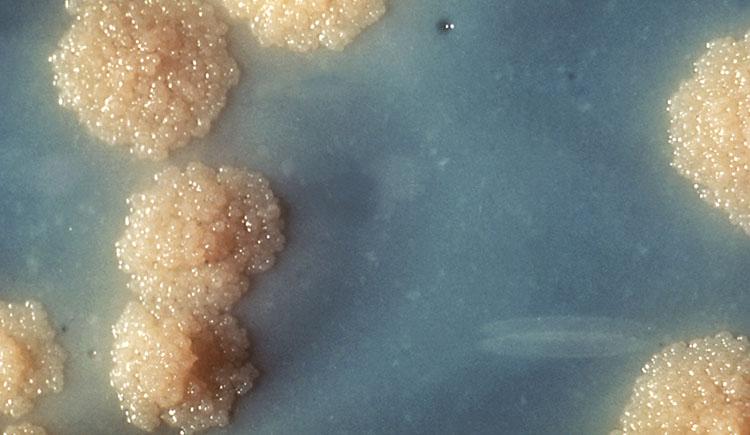 Close-up image of Mycobacterium tuberculosis bacterial colonies growing on a solid nutrient medium. The colonies appear rough, irregular, buff-colored, and bubbly, resembling small cauliflower-like clusters on a blue-gray background.
