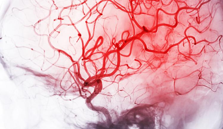 A network of thin red lines on skull-shaped gray background