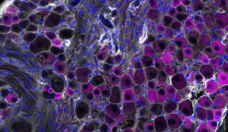 Microscopy image of vagus nerve sensory cells