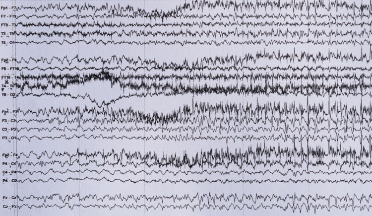 A series of irregularly spiky, black horizontal lines on a white background