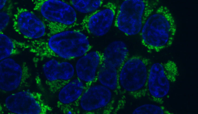A microscope imaging showing a cluster of round blue shapes surrounded by bright green and black