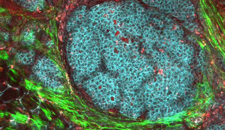 A round cluster of blue cells surrounded by bright green and dark red tissue