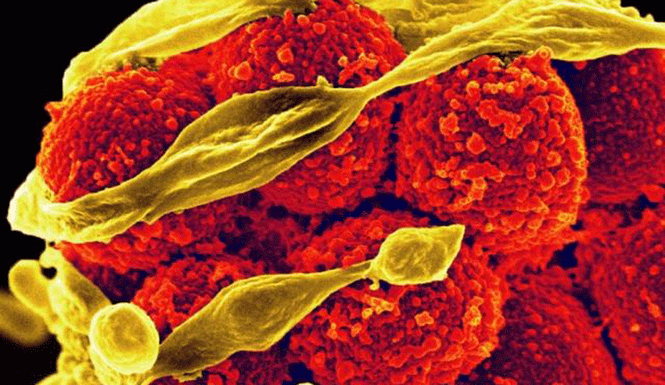 Staphylococcus aureus bacteria that have developed resistance to the antibiotic methicillin. Image: NIAID