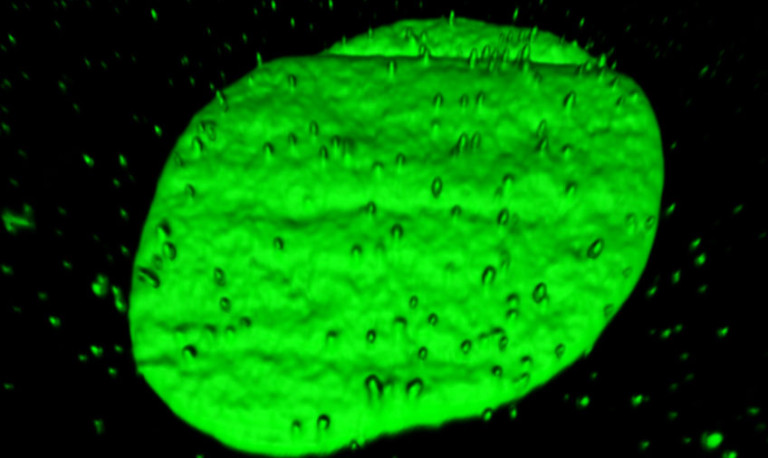 Glowing green blobs of DNA emerging from the nucleus of a human cell in a lab dish.