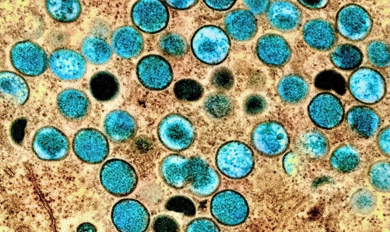 Teal-colored, speckled speres in a textured brown background.