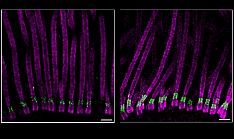 Two collections of about 10 fluorescently labeled cilia under a microscope look like long parallel strands with a short green cuff toward the bottom end.