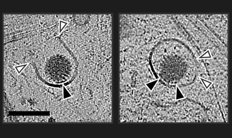 Cryo-electron microscopy views of a round rotavirus enclosed in a membrane-bound compartment. White arrows indicate where viral proteins have created an opening in the membrane.
