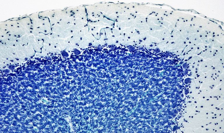 Stained cross-section of the cerebellum with Purkinje cells visible