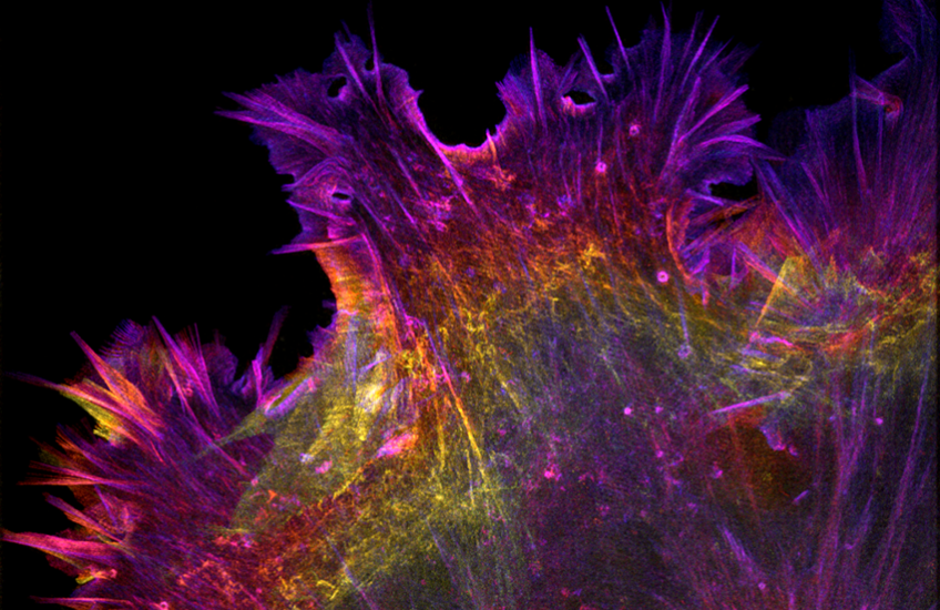Spiky cell in pink, purple, orange and yellow