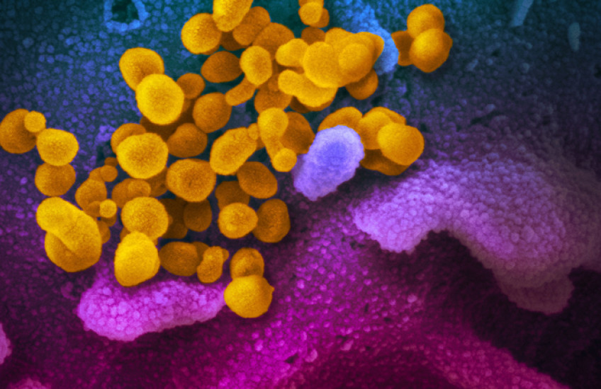 Scanning electron microscopy of new coronavirus