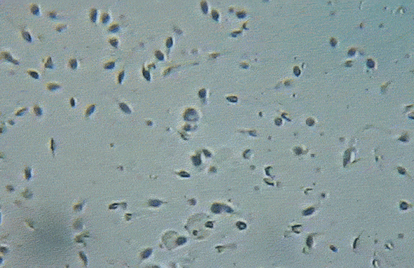 Grayscale micrograph of sperm cells swimming around