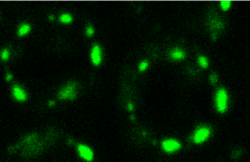 Fluorescent microscope image shows dotted green rings against a black backdrop