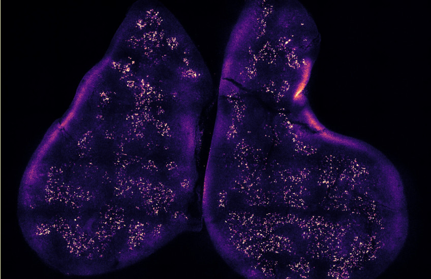 image of the thymus gland