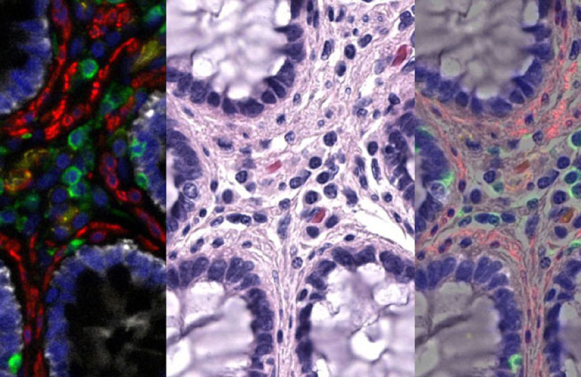 Three side-by-side images of the same starlike arrangement of cells, each in different colors