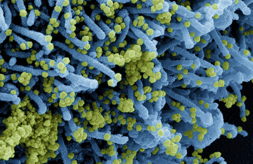 Tiny spheres of SARS-CoV-2 cover the tubular surface of a cell