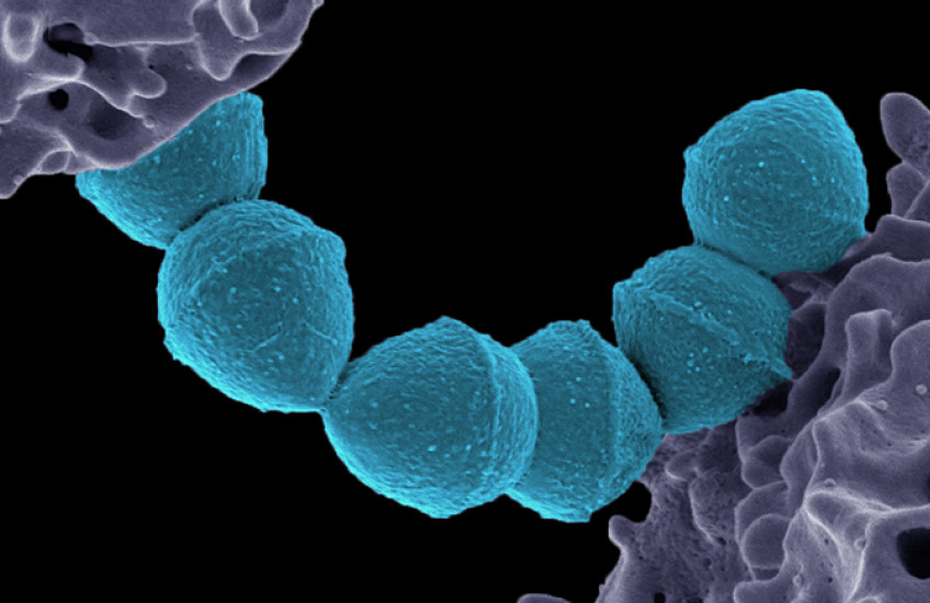 Colorized microcsope image shows six knob-like bacteria on a string