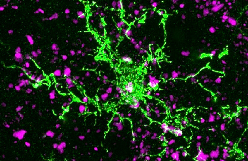 microscope image of a cell spreads out bright green against a dark background, while synapses between cells appear as scattered purple patches throughout the image